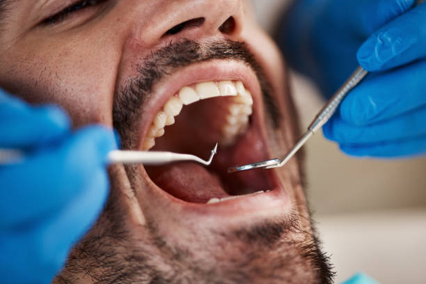Best Emergency Care for Gum Disease in Cross Lanes, WV