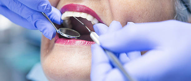 Best Dental Abscess Treatment in Cross Lanes, WV